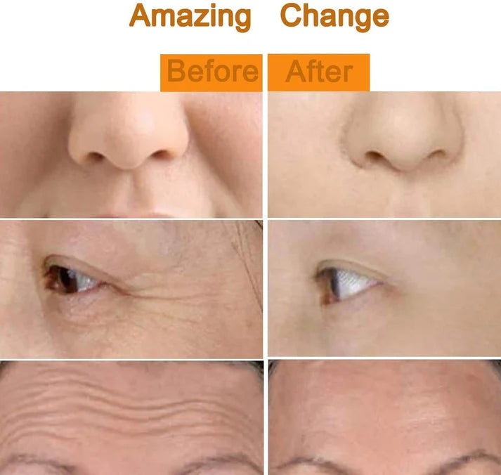 RadiantPulse™ Gold Beauty Bar